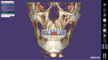 exoplan Core (Initial Purchase)
